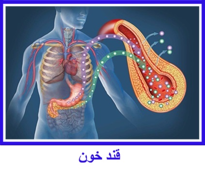 قند خون
